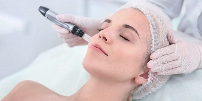 Microneedling With Prp